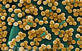 Токсичные материалы в вашей спальне: как их обнаружить?