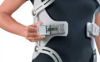 Как выбрать корсет при компрессионном переломе позвоночника