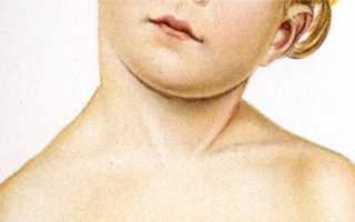 Как выбрать корсет для шеи