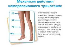 Как выбрать размер чулков чтобы не давили